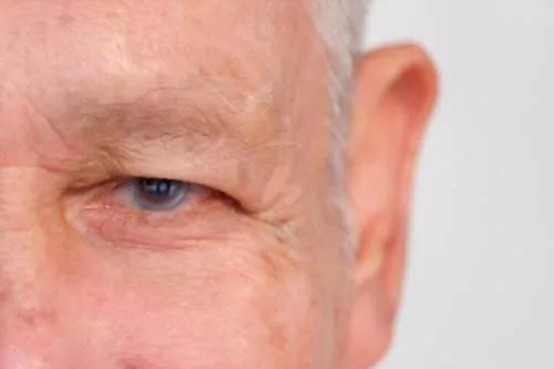 Queratitis en Monterrey: Diagnóstico y cuidados avanzados de la córnea